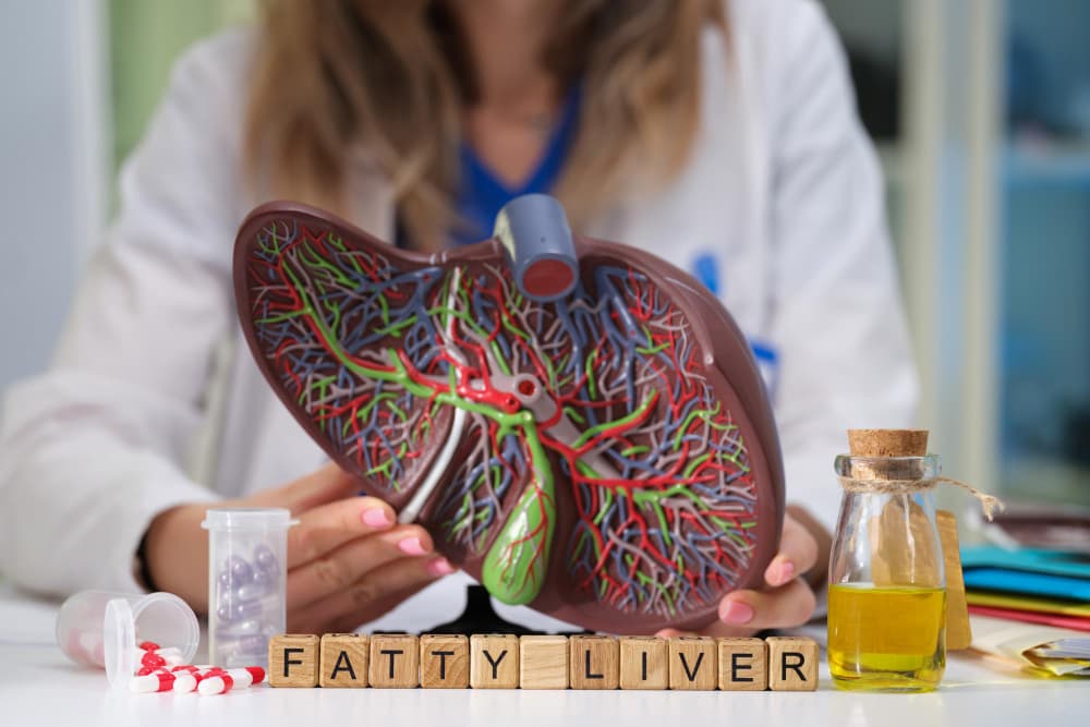 Fatty Liver Disease in India Prevention, Diet, and Ayurvedic Remedies